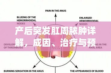 产后突发肛周脓肿详解，成因、治疗与预防攻略